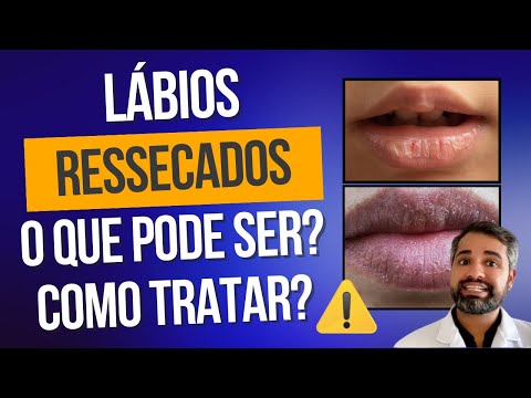 Francisco De Assis Almeida Lima Júnior-131