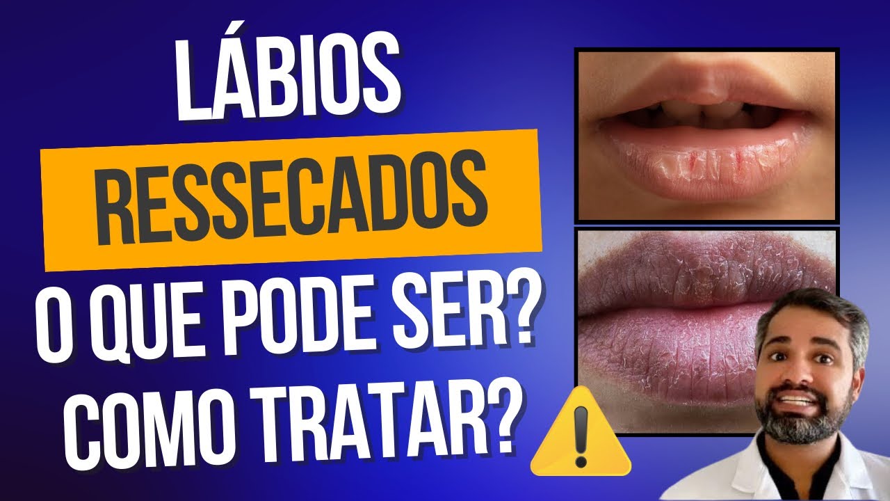 Francisco De Assis Almeida Lima Júnior-131