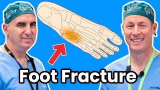 How To Treat Your Broken Foot. Jones and Fifth Metatarsal Fractures