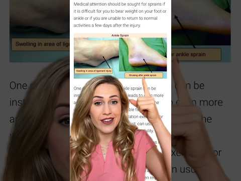 How to tell if your ankle is sprained