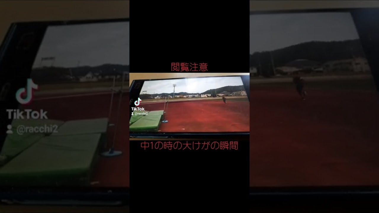 [閲覧注意]中1の時の走り高跳びの練習でのけが