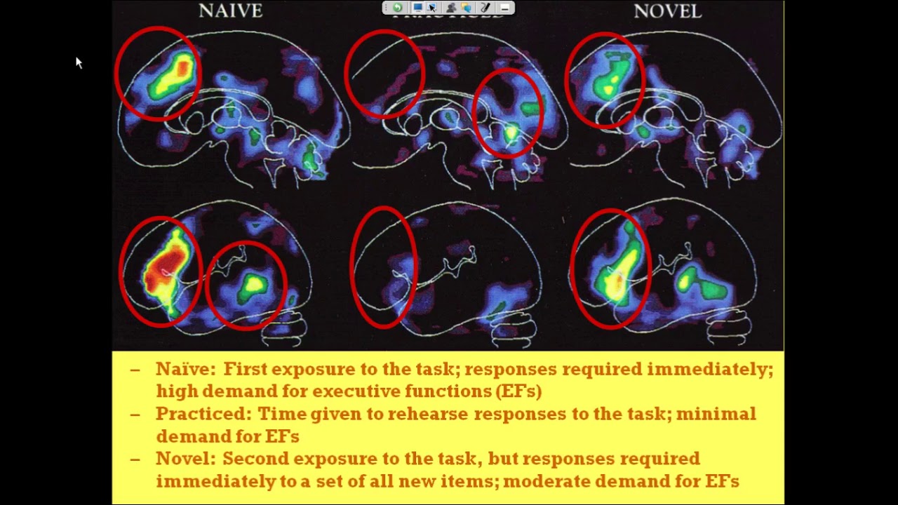 Webinar video