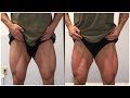 Graston for Quads and Hammies - On my last leg day!