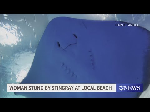Austin woman recounts 'kiss with a stingray' incident at Port Aransas beach