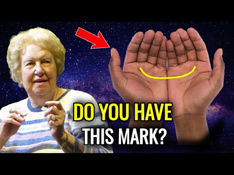 REVEALED: The True Meaning of the Half Moon Mark on the Palm!💥 Dolores Cannon