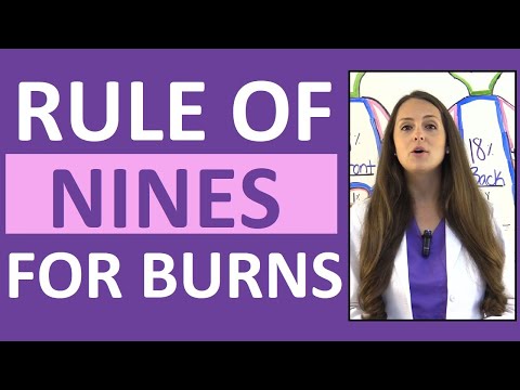 Rule of Nines for Burns in Adults Nursing NCLEX Lecture w/ Examples