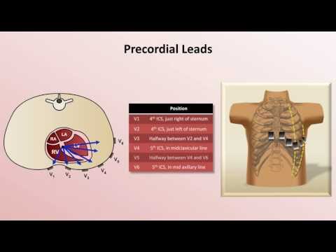 Intro to EKG Interpretation - EKG Leads