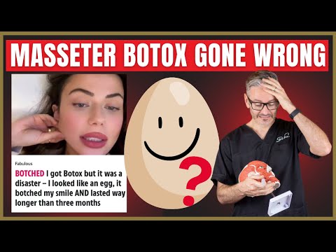 Avoid this Botox mistake | The Expert Advice You Need Before Injecting The Masseters
