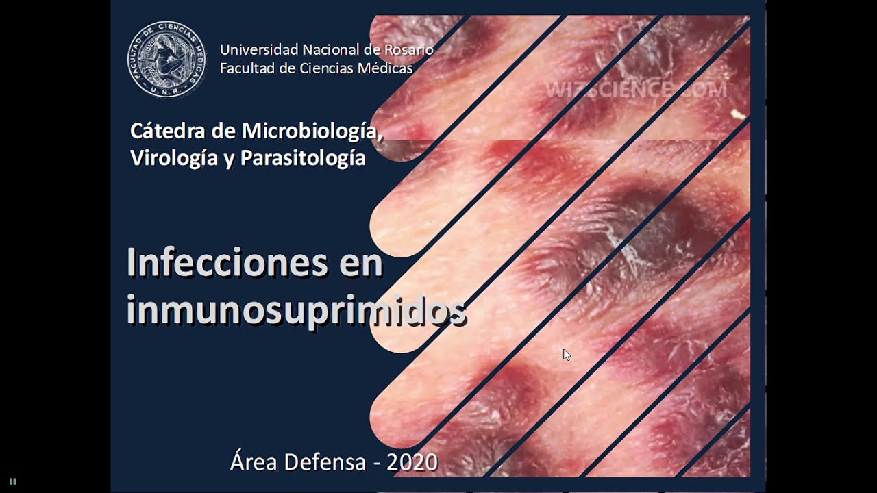 Seminario Defensa 08(A) -  Infecciones en inmunosuprimidos