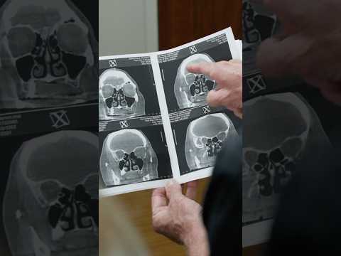 Do you suffer from sinus infections?