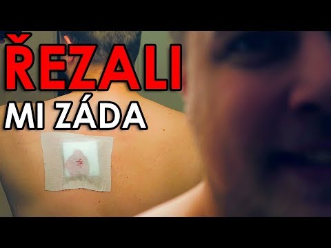 ŘEZALI MI ZÁDA - WEEK #185