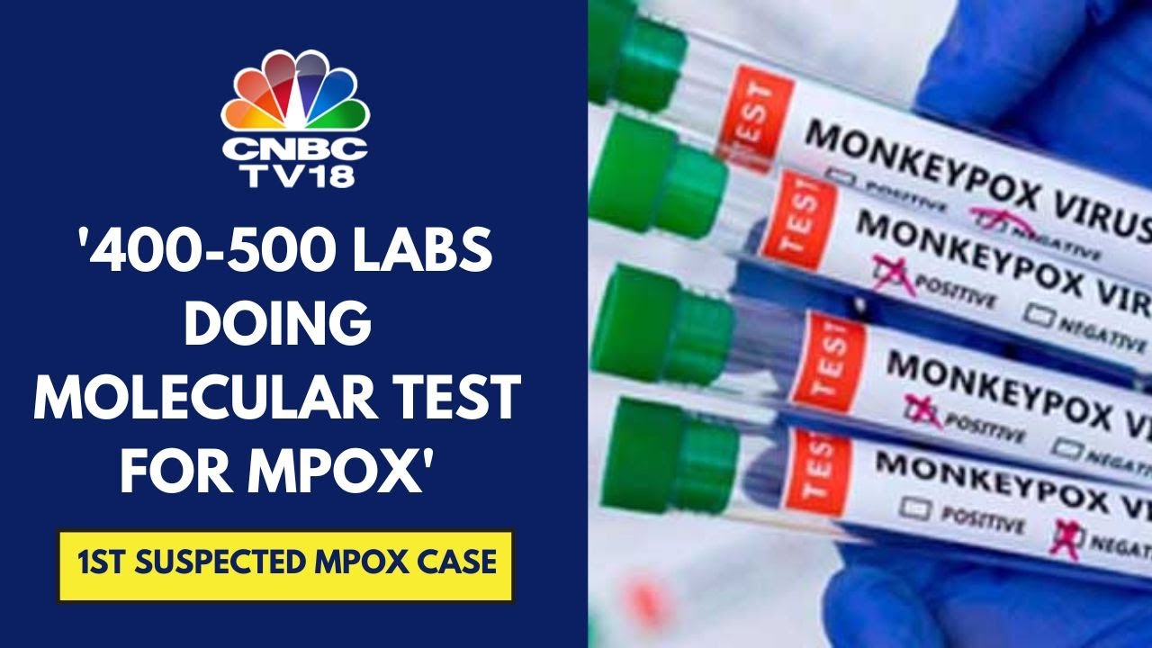Direct Contact & Contaminated Material From Patient Can Lead To Mpox Transmission: Metropolis