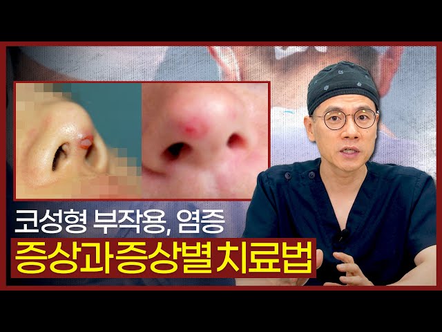 코성형과 얼굴형 잘하는 정우성형외과_코재수술ㅣ코재건_이물질 제거 코성형과 얼굴형 잘하는 정우성형외과_코재수술ㅣ코재건_이물질 제거