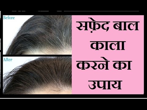 Safed Baalon ko Kaala Kaise Karen | White Hair Home Remedies | Reverse Gray Hair Naturally in Hindi Video