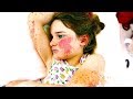 WE FOUND HER WITH MACULOPAPULAR RASH (SHOCKING) WE FOUND HER WITH MACULOPAPULAR RASH (SHOCKING)