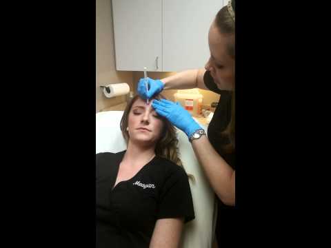 Delay aging with Botox