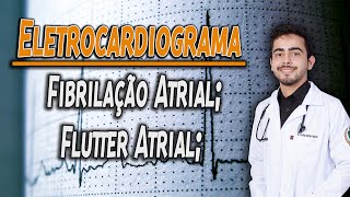 Eletrocardiograma: Arritmias - Fibrilação Atrial, Flutter, Taquicardia Sinusal │ Capítulo 13 GUYTON