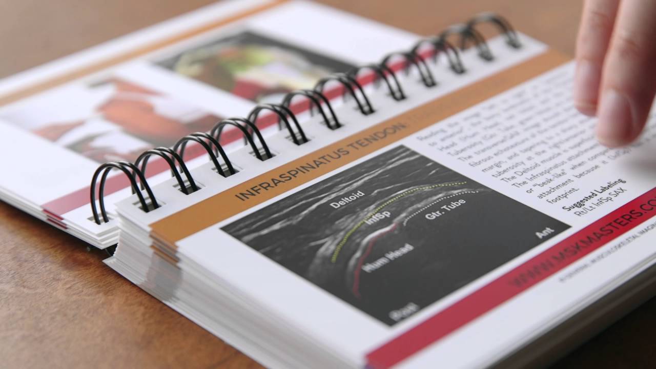 MSK Study Flash Cards Now Available !