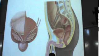 8) Dr. Hossam 09-04-2015 [ End of prostate ]