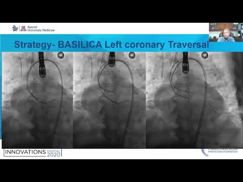 How I managed a difficult balloon-expanding TAVR case - Ashish Pershad, MD