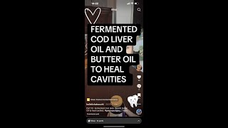How To Heal Cavities Naturally Using Fermented Cod Liver and Butter Oil