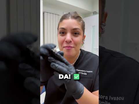 Ce poti manca cu aparat dentar