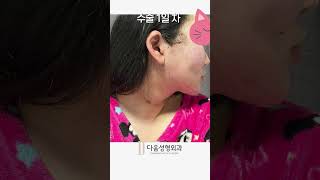 배우자은이가 추천하는 친절한 피부과 강남다움의원 아세요~ #피부 #미백 #강남다움의원 #배우 #이자은 #미용