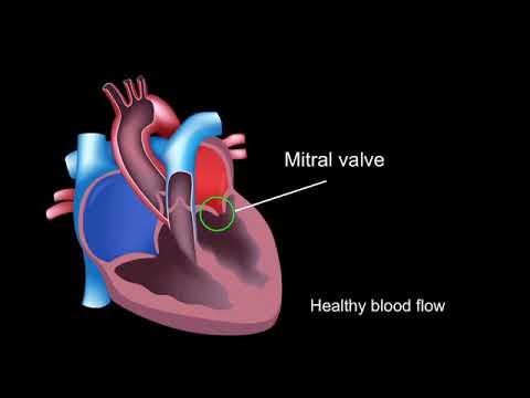 Physiology of rheumatic heart disease