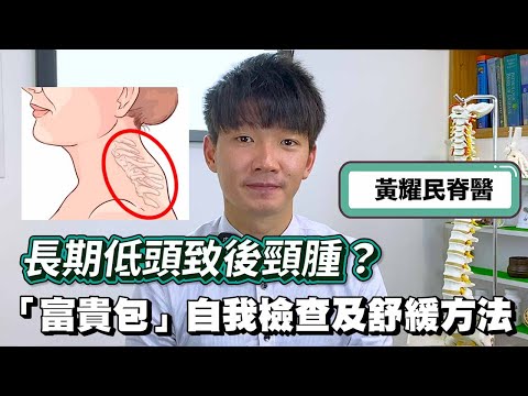 長期低頭致後頸腫？富貴包自我檢查及舒緩方法 | 正一脊科及物理治療