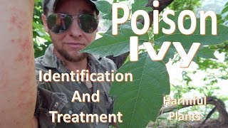 Poison Ivy Encounter Identificaton and Treatment