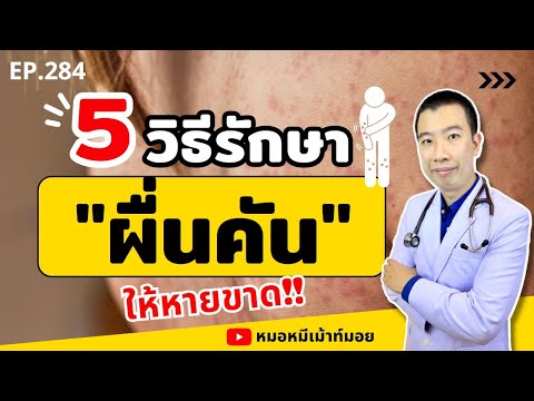 5 วิธีรักษาผื่นคัน ให้หายขาด สำหรับคนแพ้ง่าย | เม้าท์กับหมอหมี EP.284