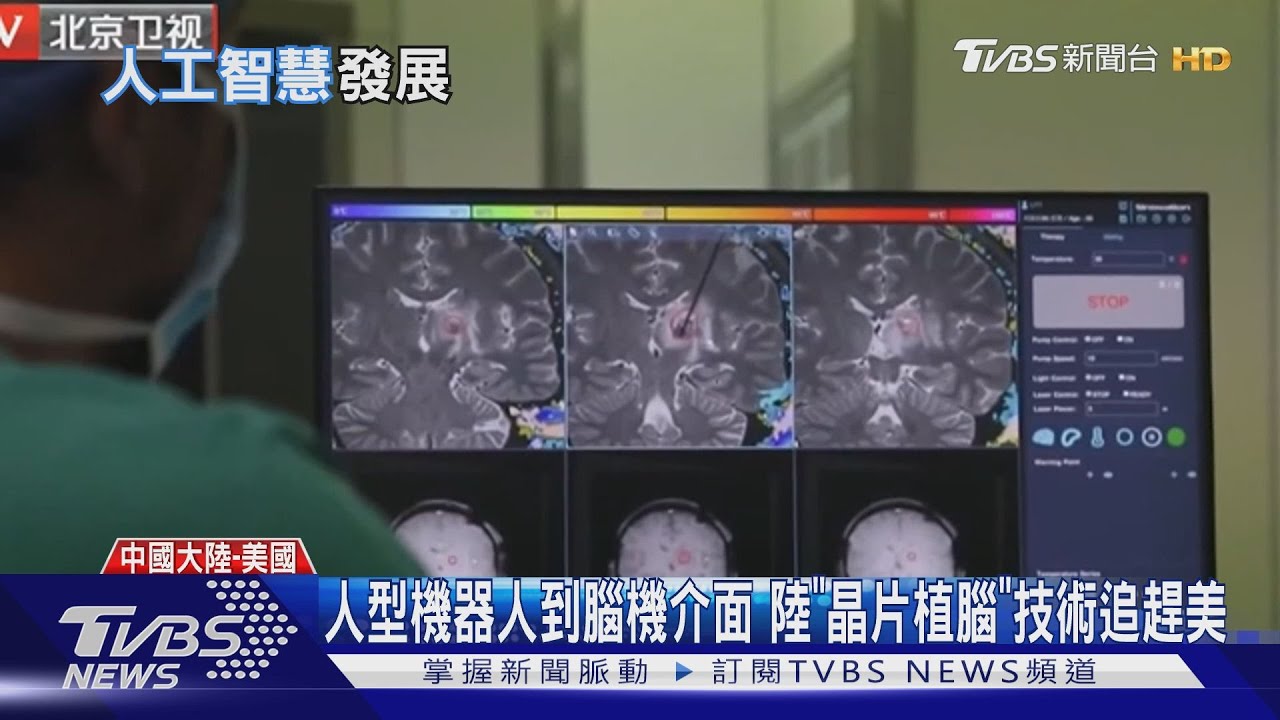從人型機器人到腦機介面 大陸「晶片植腦」技術追趕美