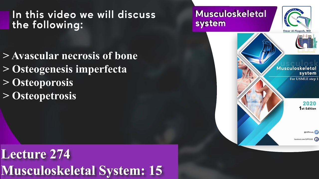 Avascular necrosis of bone | Osteogenesis imperfecta | Osteoporosis | Osteopetrosis