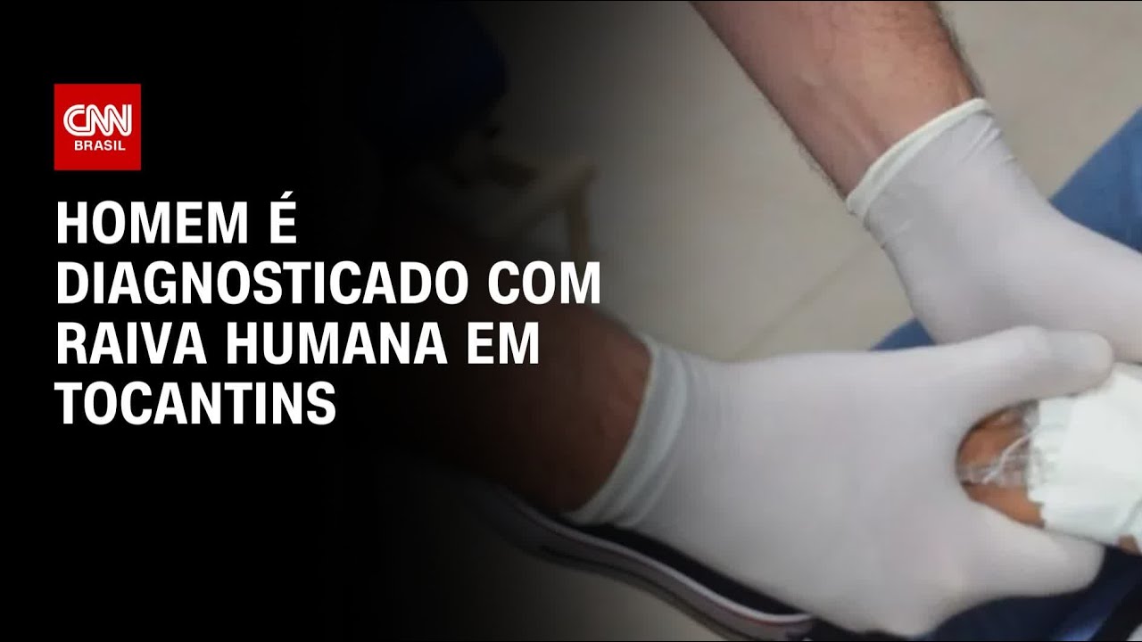 Homem é diagnosticado com raiva humana em Tocantins | AGORA CNN