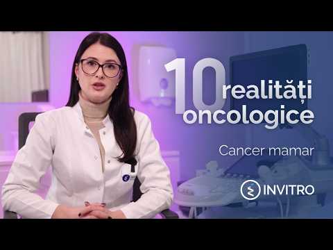 10 realități oncologice descrise de către medicul mamolog-oncolog