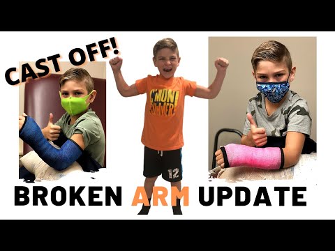 UPDATE #2 | Broken Arm! EMERGENCY!