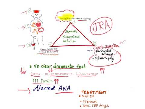 Juvenile Idiopathic Arthritis (JIA) - Juvenile Rheumatoid Arthritis (JRA) - mnemonic