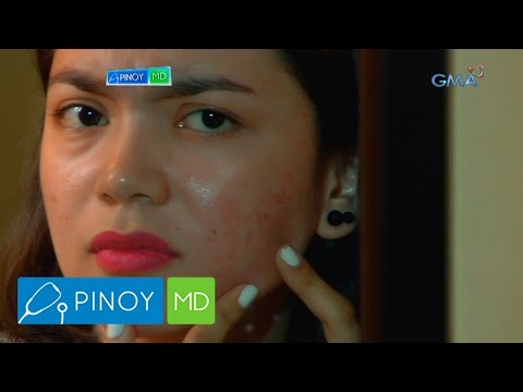 Makapal na kuko sa kalingkingan ng paa ng paggamot Halamang-singaw sa pagitan ng mga daliri sa paa ng paggamot pamahid cheap
