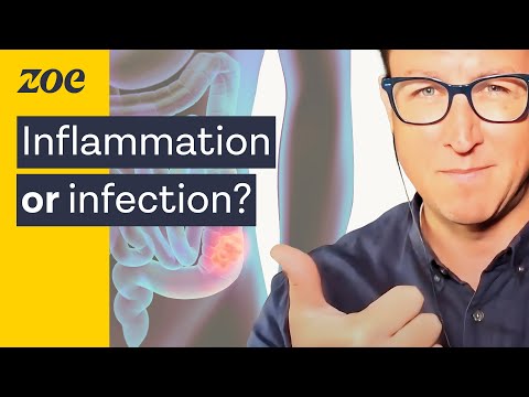 CHRONIC Diarrhea? Here's What To Do | Dr. Will Bulsiewicz