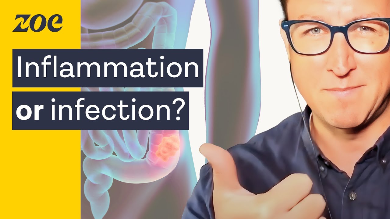 CHRONIC Diarrhea? Here's What To Do | Dr. Will Bulsiewicz