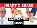 OVERLOOKED Signs Of Heart Disease, DO NOT IGNORE | Dr. Gundry