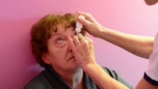 Ulss 1 Belluno -  la cataratta: il decorso post operatorio