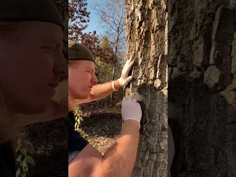 ASMR | Cranial Nerve Exam On A Tree 🌳