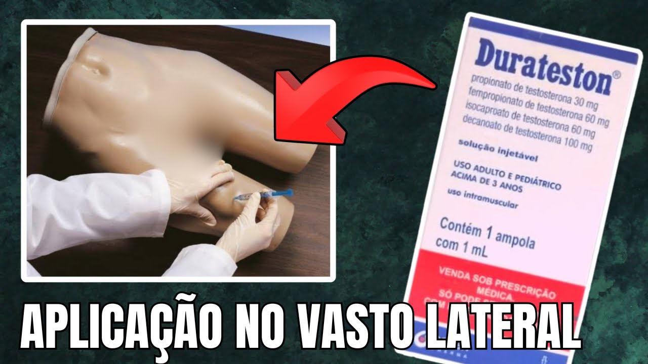 APLICAÇÃO DE DURATESTON NO VASTO LATERAL - #DRJORGECORTES