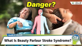 What Is Beauty Parlour Stroke Syndrome?