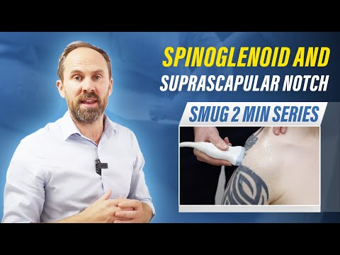 Spinoglenoid and Suprascapular Notch - 2 min series MSKUS