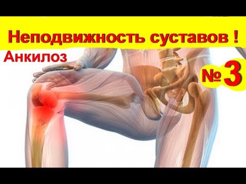 Цены в екатеринбурге на мрт коленного сустава в В и дикуль жизнь без боли в спине читать онлайн