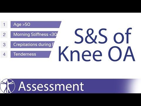 Signs & Symptoms of Knee Osteoarthritis