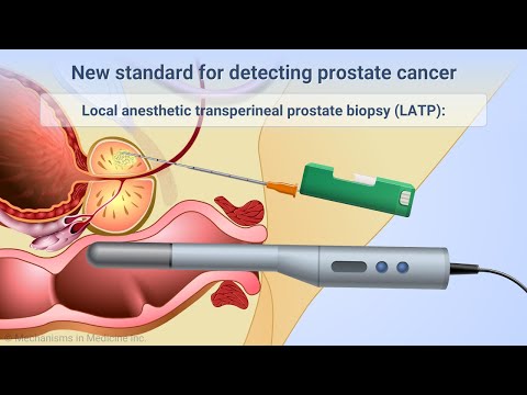 Prostatitis a srácokban