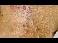 Enjoy Facial Treatment With Chung Vo Spa New Videos 140